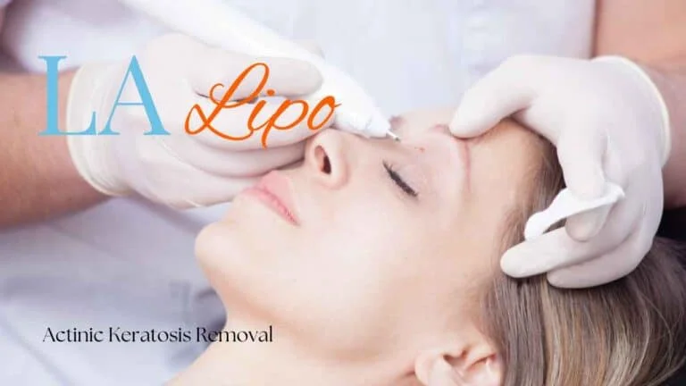 Woman receiving Actinic Keratosis Removal Treatment Midhurst