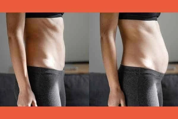 LA-EMS Body Sculpting results Midhurst