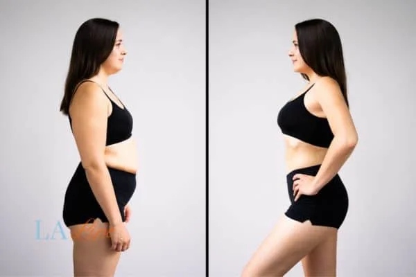 link between body image and mental health Midhurst