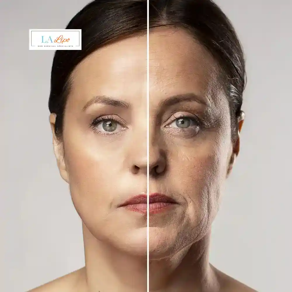 How Can You Tell If Non-Surgical Skin Tightening Is Right for You Midhurst?