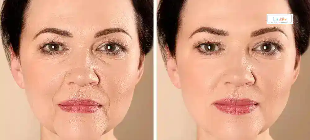 Why Aren’t My Skincare Products Making My Sagging Skin Look Firmer Midhurst?
