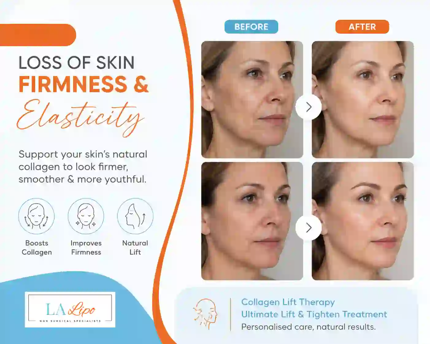 Sign #7: Loss of Skin Firmness and Elasticity Midhurst